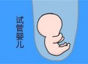 培养保定捐卵宝宝艺术细胞的小技巧